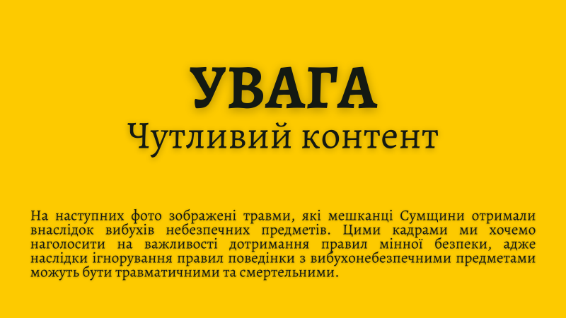 Про важливість домедички для мешканців Сумщини та пацієнтів із мінно-вибуховими травмами: розмова із медиком (ФОТО 18+)