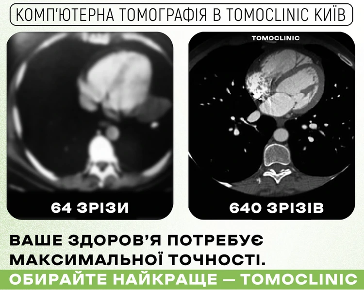 онкоскринінг