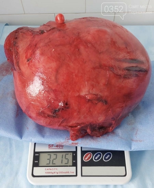 У Тернопільському перинатальному центрі провели надскладну операцію (ФОТО)