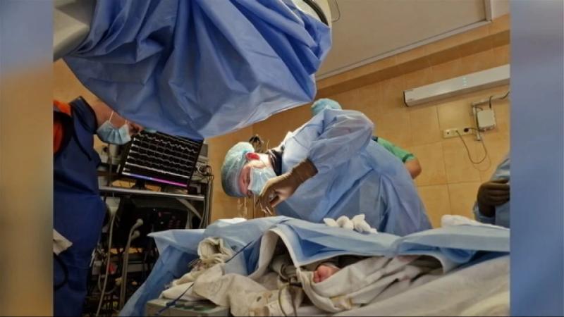 "Історичний прорив у кардіохірургії": одеські медики вперше у світі вживили електрод у серце 8-місячної дитини