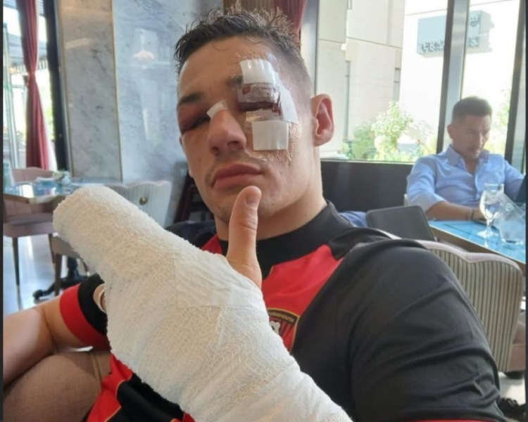 Кріс Біллам-Сміт: "Після поразки розмір гонорару за бій впав колосально"