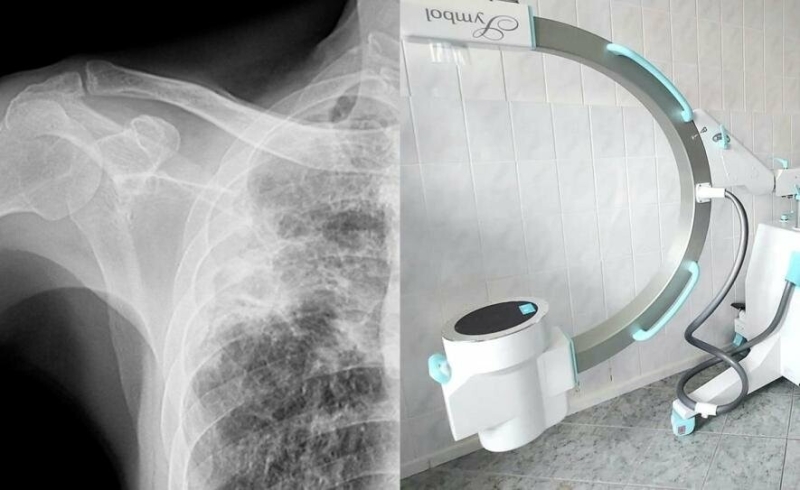 Миколаївська лікарня купить мобільний рентген за 12 мільйонів гривень