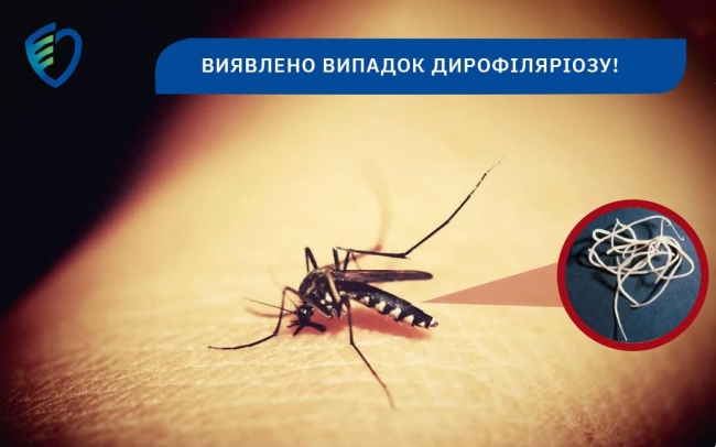 З ноги жінки з Полісся видалили довжелезного гельмінта