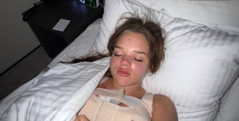 Підтяжка грудей обернулася важкими ускладненнями: франківська блогерка-мільйонниця поскаржилася на пережите (ФОТО)