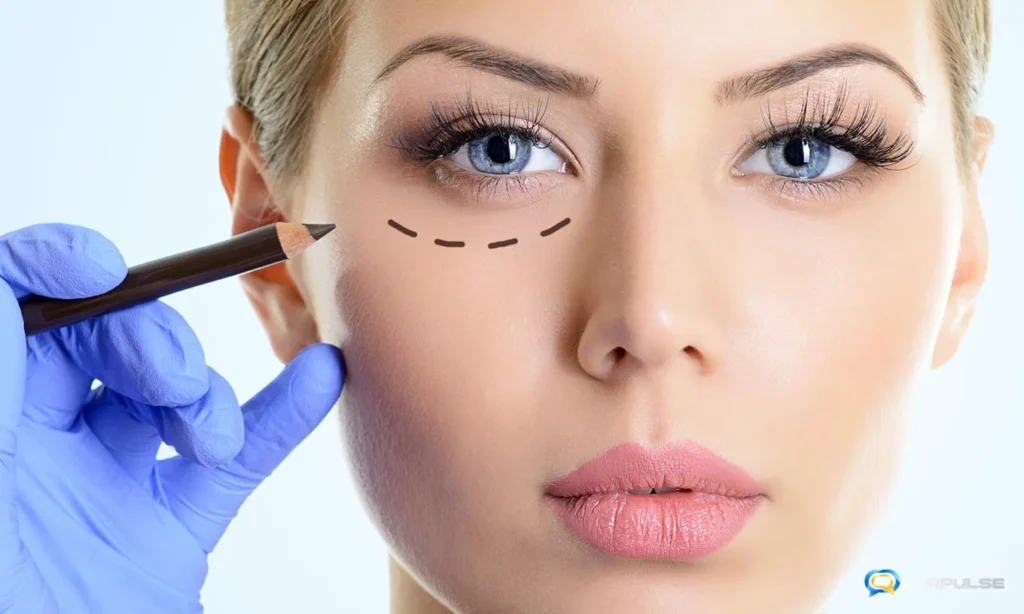блефаропластика lita plus clinic