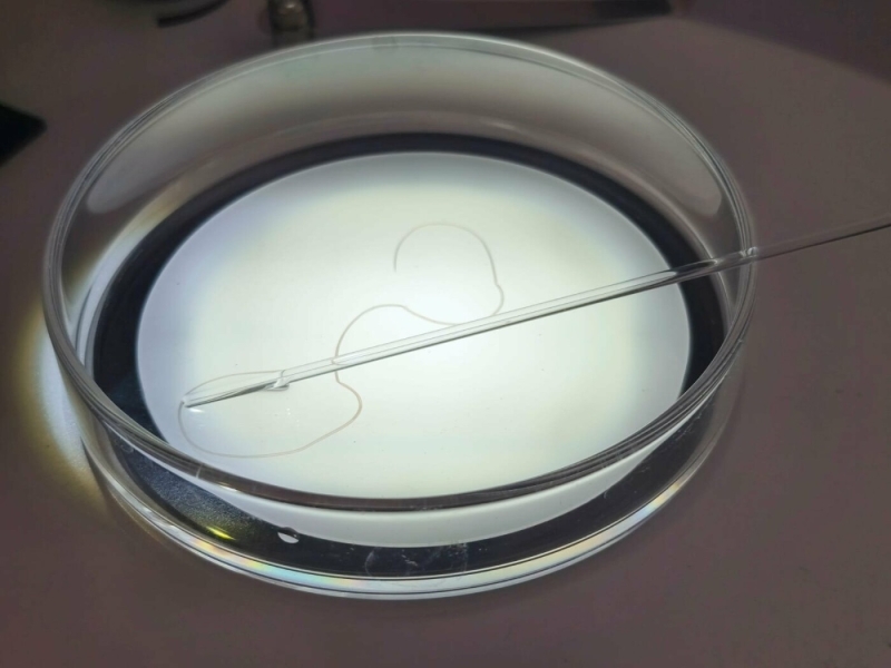 У Запоріжжі виявили зараження паразитом після укусу комара: черв&rsquo;яка витягли з повіки пацієнта