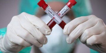 На Дніпропетровщині значно зросла захворюваність на COVID-19