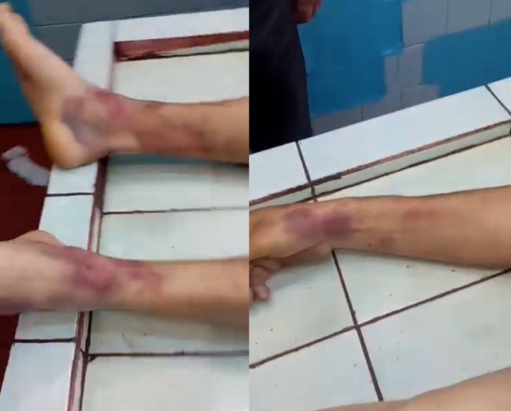 - Тіло усе синє, - матір померлого чоловіка стверджує, що його побили у ТЦК в Сарнах (ФОТО/ВІДЕО)