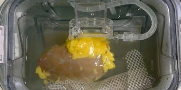 Науковці вперше створили  універсальну  нирку для трансплантації