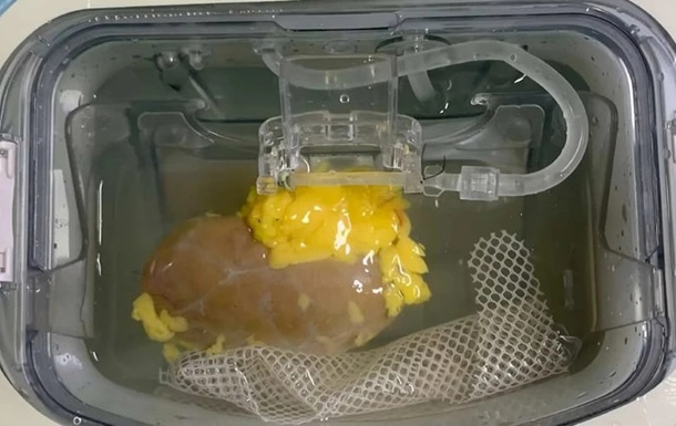 Науковці вперше створили універсальну нирку для трансплантації