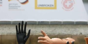 У Миколаєві відкриють сучасну протезну майстерню, – ФОТО