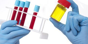 вільний бета-хоріонічний гонадотропін