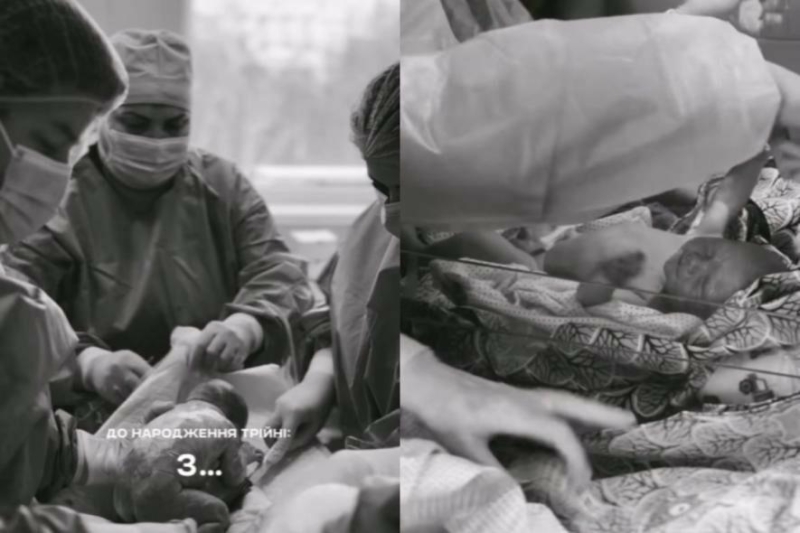 Справжнє диво: миколаївські медики прийняли трійню шляхом кесаревого розтину, - ВІДЕО