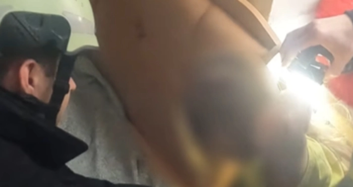 У Луцьку рятувальники визволили руку дівчинки з чавунної батареї