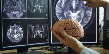 Вчені пояснили механізм втрати пам яті при хворобі Альцгеймера