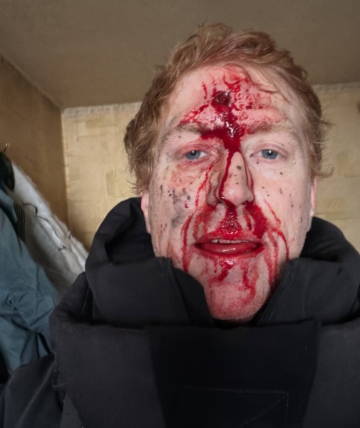 Легендарний волонтер "Голландець", який евакуював тисячі людей, отримав поранення (ФОТО 18+,  ВІДЕО)