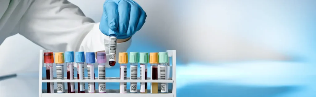 лабораторна діагностика