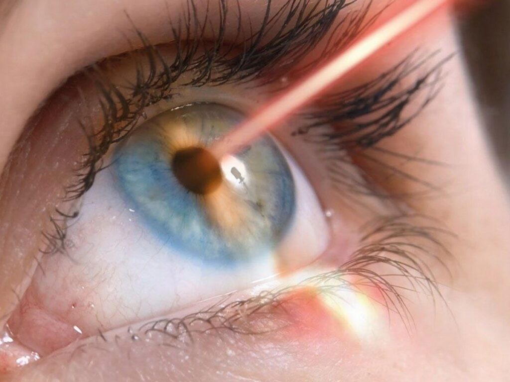 лазерна корекція зору світогляд полтава