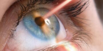 лазерна корекція зору світогляд полтава