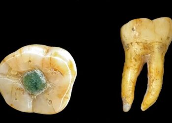 Давні мая використовували дорогоцінні камені як пломби