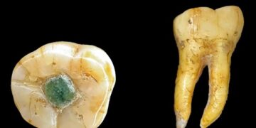 Давні мая використовували дорогоцінні камені як пломби