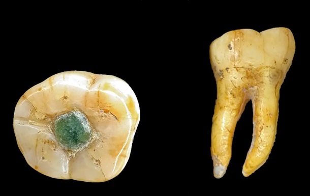 Давні мая використовували дорогоцінні камені як пломби