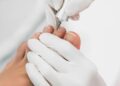 Медичний апаратний педикюр та врослий ніготь: чому подолог — це не майстер манікюру