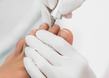 Медичний апаратний педикюр та врослий ніготь: чому подолог — це не майстер манікюру