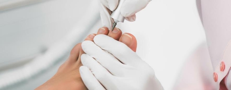 Медичний апаратний педикюр та врослий ніготь: чому подолог &mdash; це не майстер манікюру