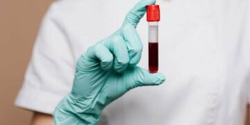 Як запобігти інфікуванню хантавірусом: рекомендації Центру громадського здоров’я