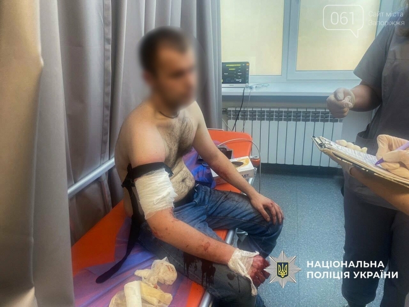 У Запоріжжі чоловік з ножем напав на поліцейських, правоохоронці застосували зброю