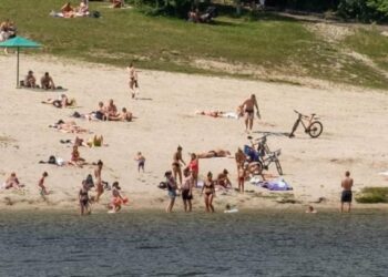 Лікарі попередили: популярна помилка після сонячних опіків лише погіршує стан шкіри